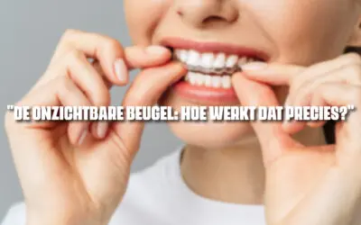 De onzichtbare beugel: hoe werkt dat precies?