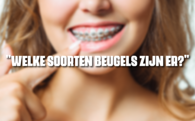 Welke soorten beugels zijn er?