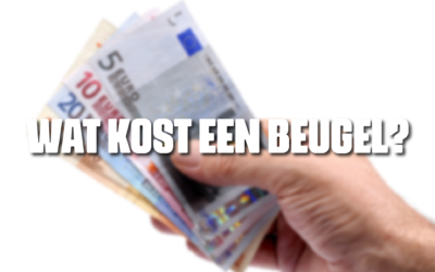 Wat kost een beugel?