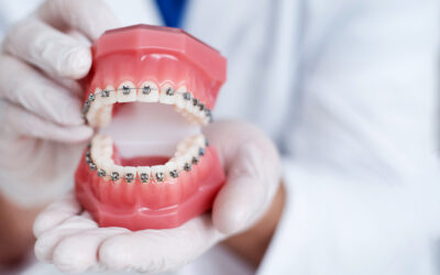 Beugel Tandarts Ortho Billet – De Best Beoordeelde Orthodontist in Nederland