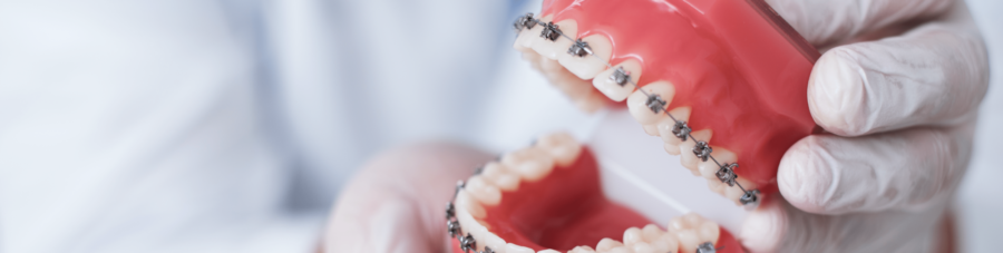 Beugel Praktijk Ortho Billet