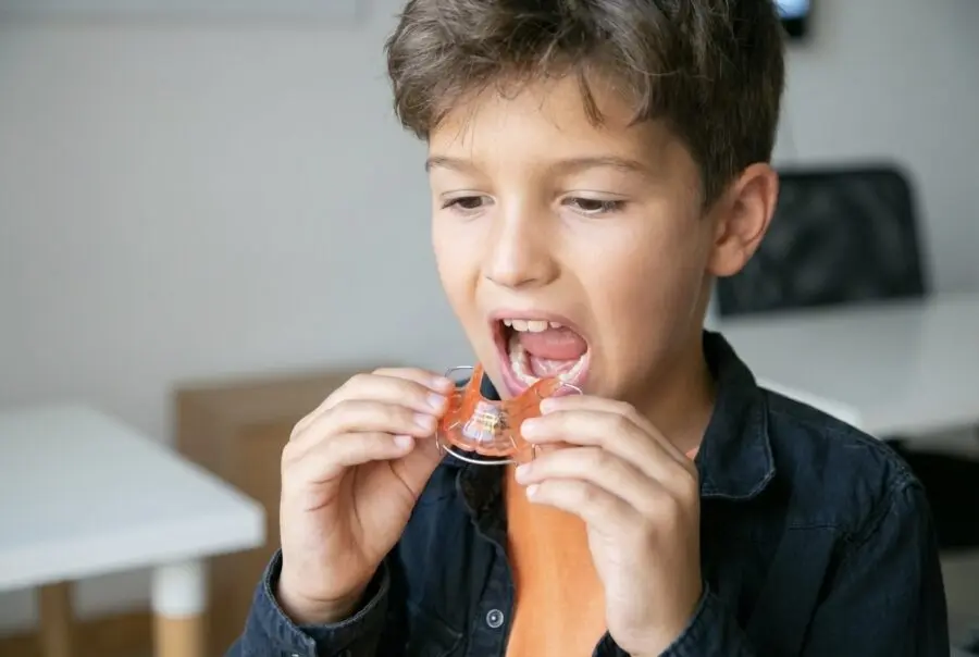 Orthodontiepraktijk Ortho Billet Activator beugel kind