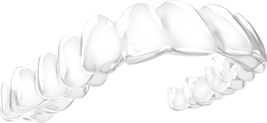 Orthodontiepraktijk Ortho Billet Spark Aligners bitje beugel