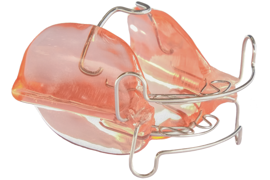 Uitneembare activator blokbeugel voor overbeet correctie bij kinderen, orthodontist in de buurt van Rotterdam en Den Haag