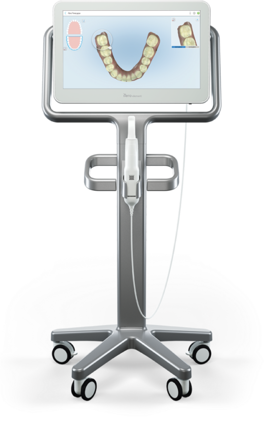iTero 3D-scanner orthodontiepraktijk Ortho Billet gebitscan